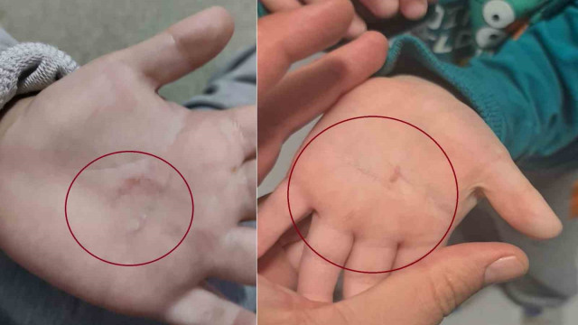 Bandırma Belediyesi’nin kreşinde 4 yaşındaki çocuğa şiddet iddiası