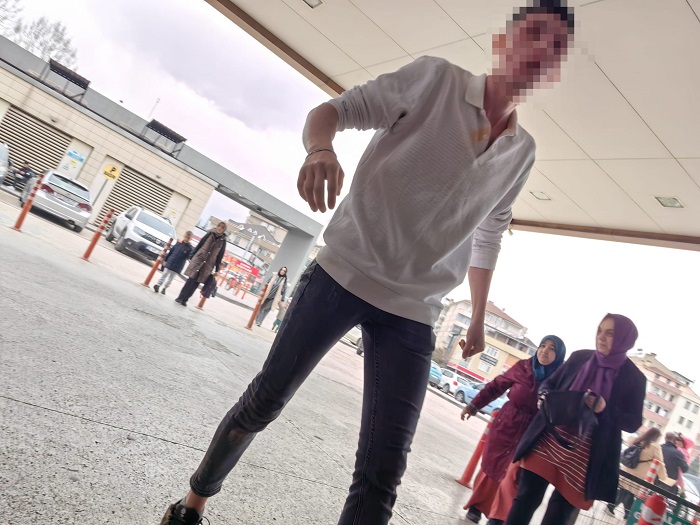 Sevgilisinin abisini darp etti