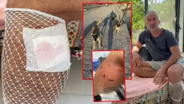 Yürüyüş yaparken köpek saldırısında yaralandı